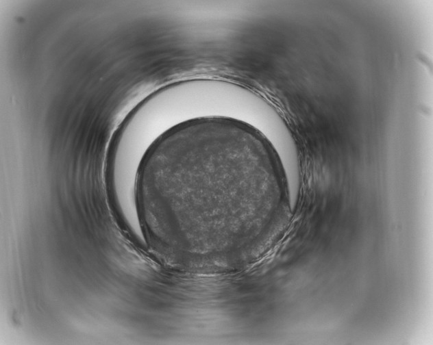 X0000098160292200805081110
