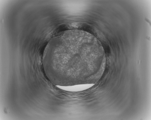X0000098160331200805081109