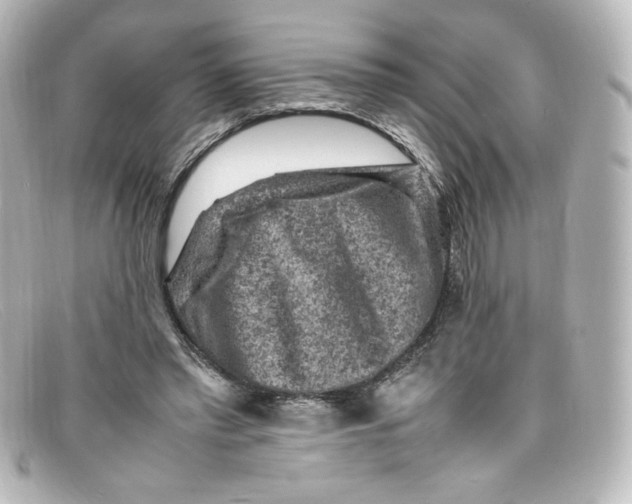 X0000098160397200805081108