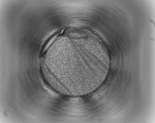 X0000098160446200805081107