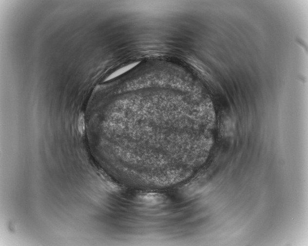 X0000098160467200805081107