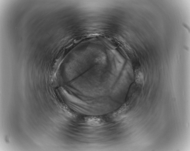 X0000098160471200805081107