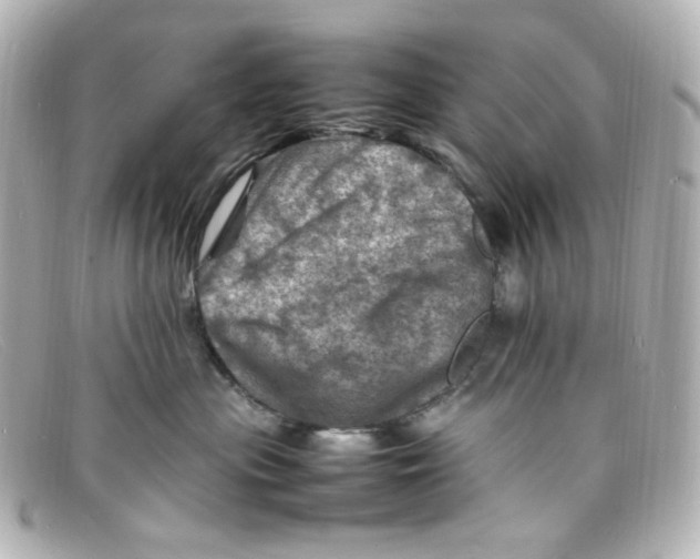 X0000098160477200805081107