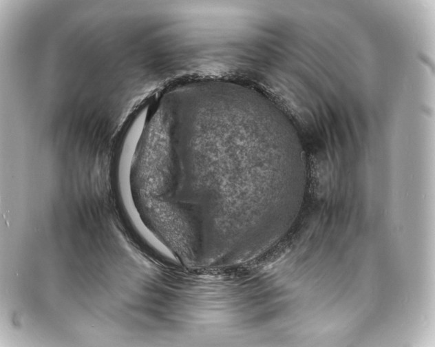 X0000098160496200805081107