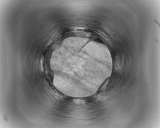 X0000098160520200805081106