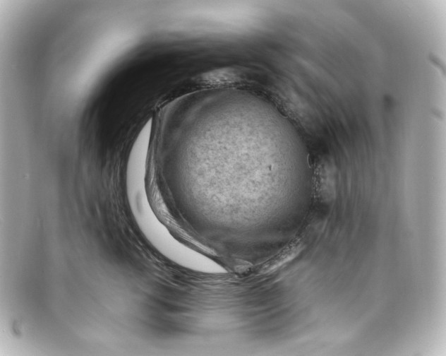 X0000098160762200805081103