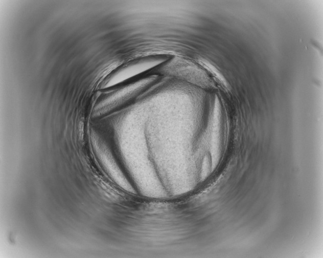 X0000098160777200805081103