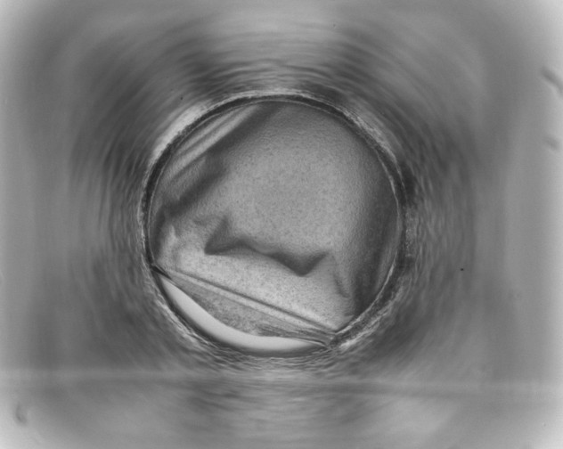 X0000098160789200805081102
