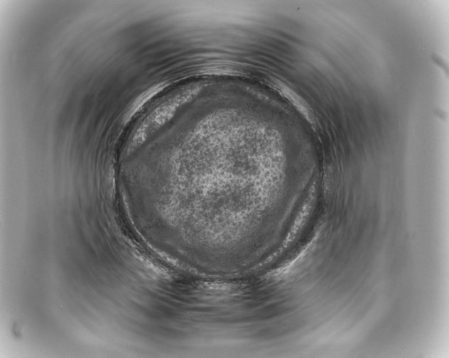 X0000098160829200805081102