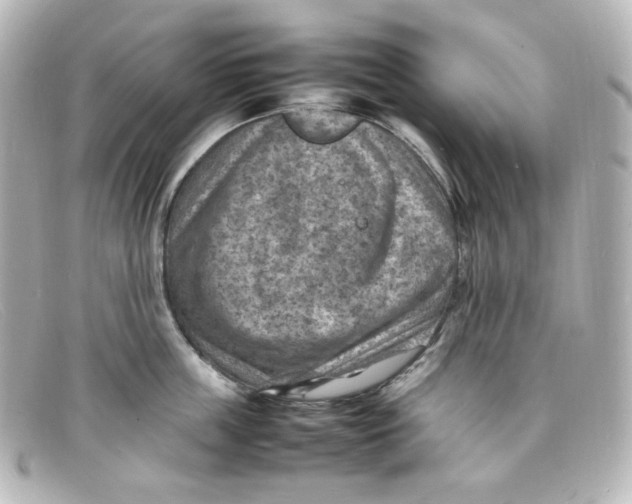 X0000098160859200805081102