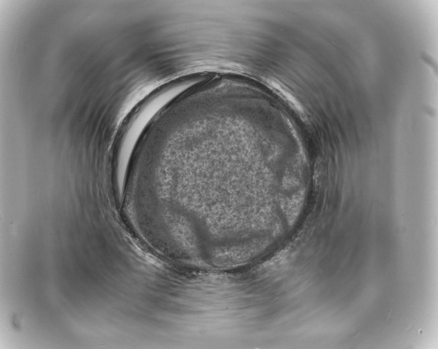 X0000098160877200805081101