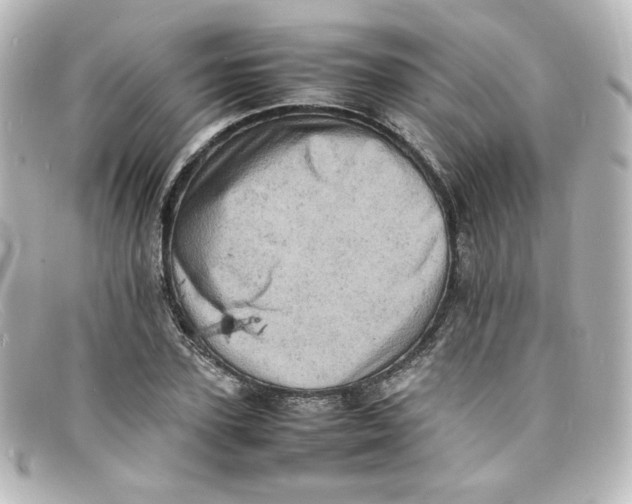 X0000098160931200805081100