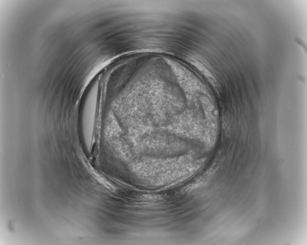 X0000098160933200805081100