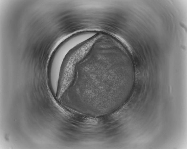 X0000098160935200805081100