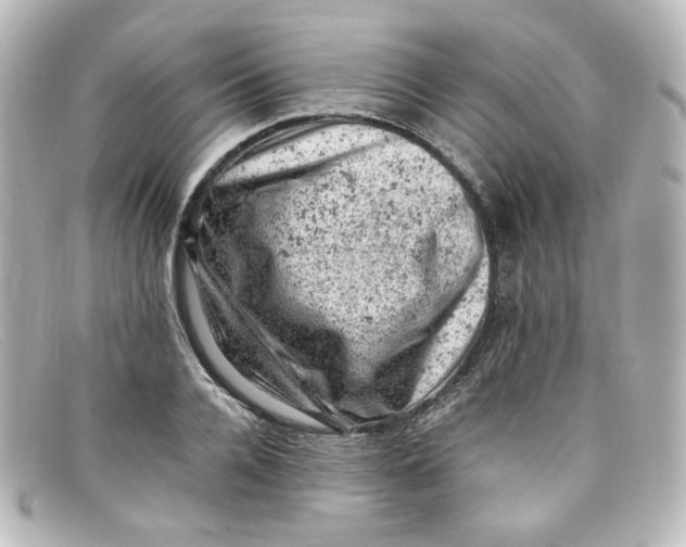 X0000098160936200805081100