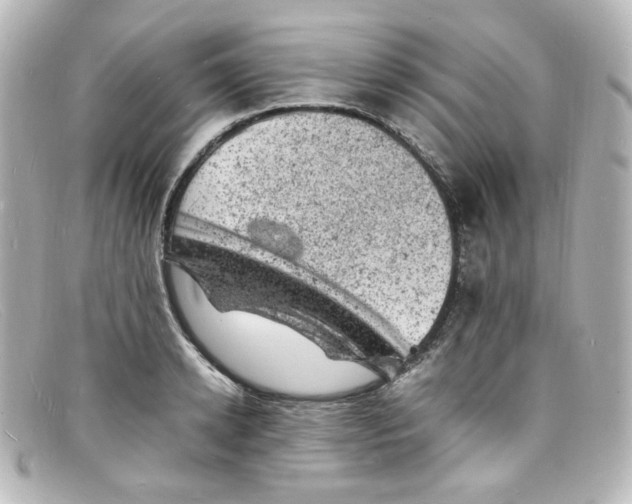 X0000098160942200805081101