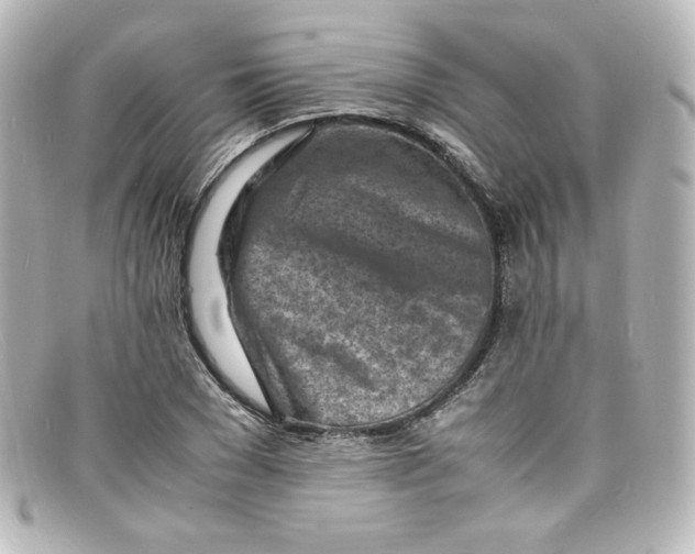 X0000098160977200805081100