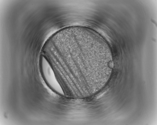 X0000098160991200805081100