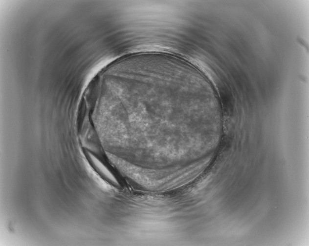 X0000098160995200805081100