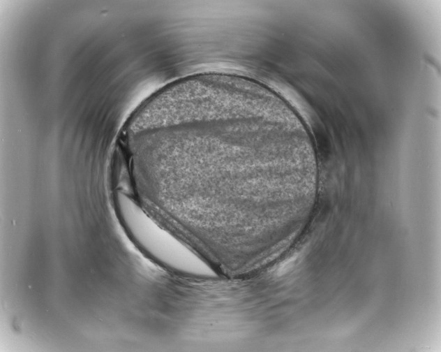 X0000098160999200805081100