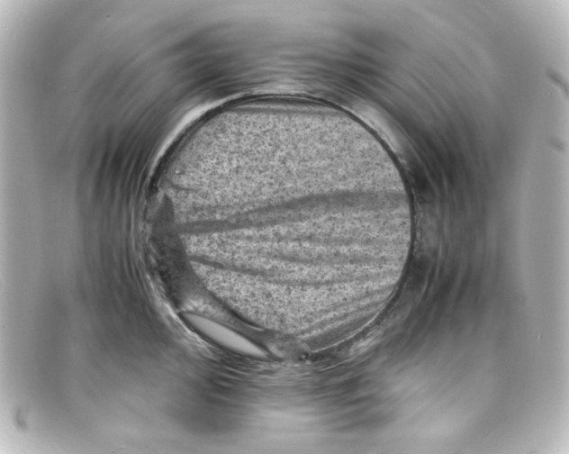 X0000098161000200805081100