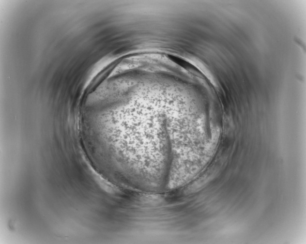 X0000098161101200805081058