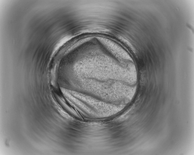 X0000098161114200805081058