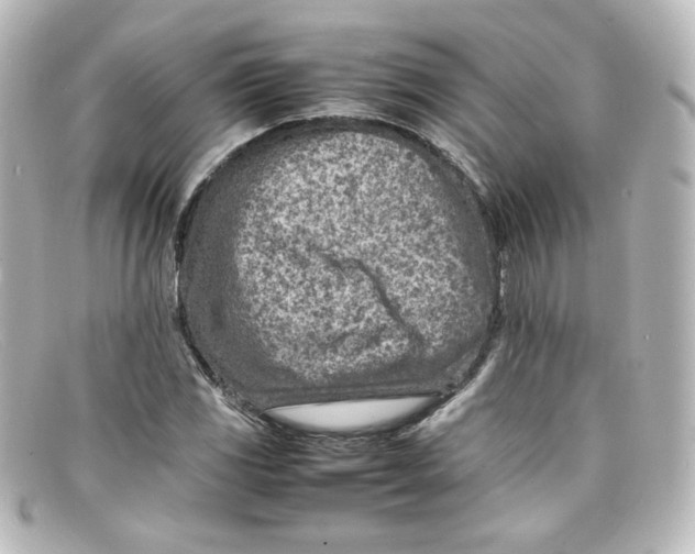 X0000098161117200805081058