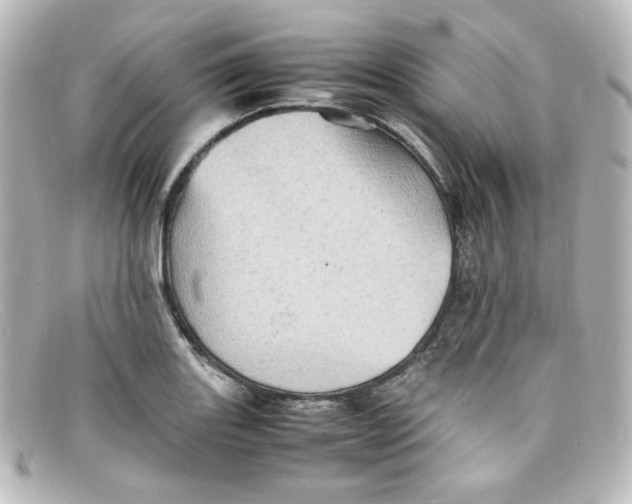 X0000098161131200805081058