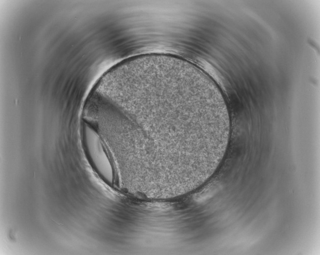 X0000098161132200805081058