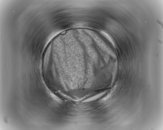 X0000098161149200805081058