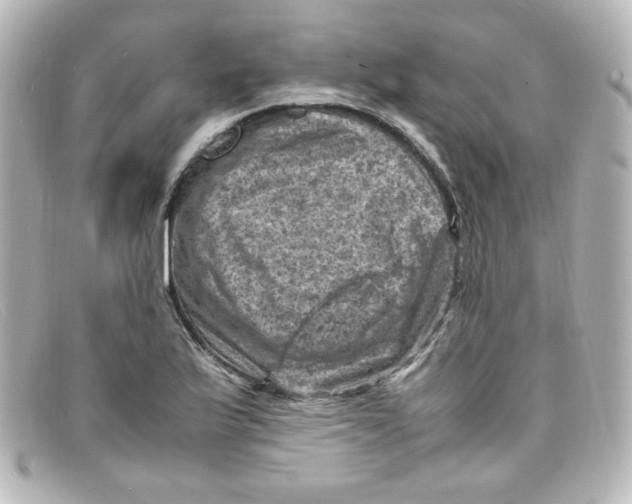 X0000098161175200805081057