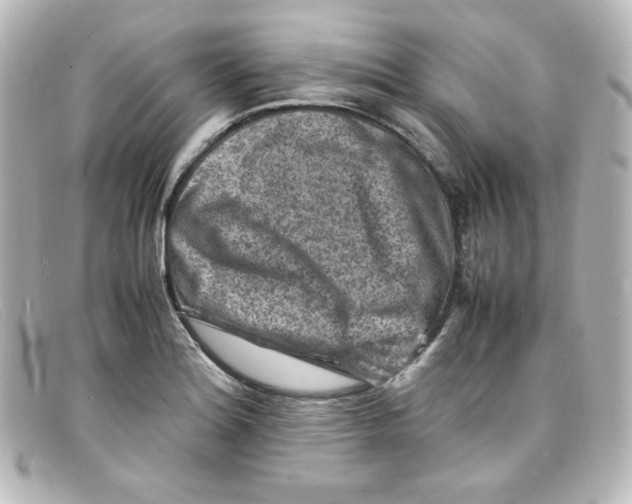 X0000098161180200805081057