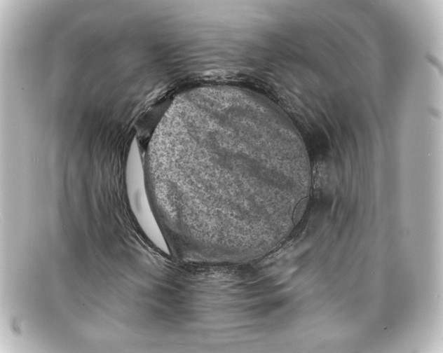 X0000098161202200805081056