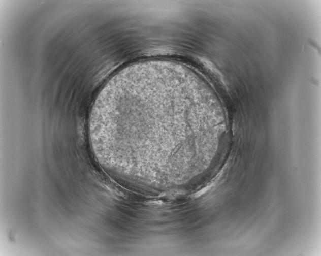 X0000098161217200805081056