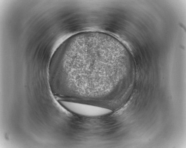 X0000098161239200805081057