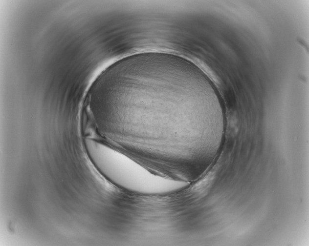 X0000098161246200805081057