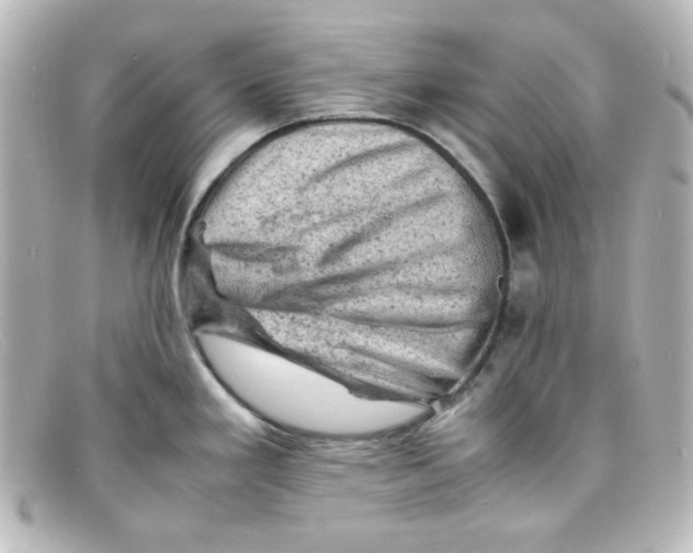 X0000098161293200805081055