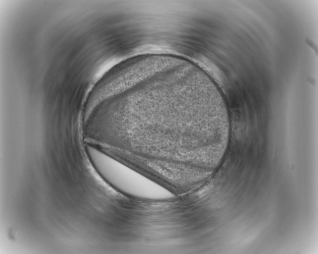 X0000098161382200805081054