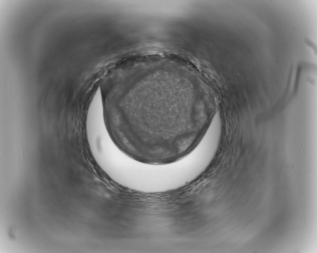 X0000098161445200805081053