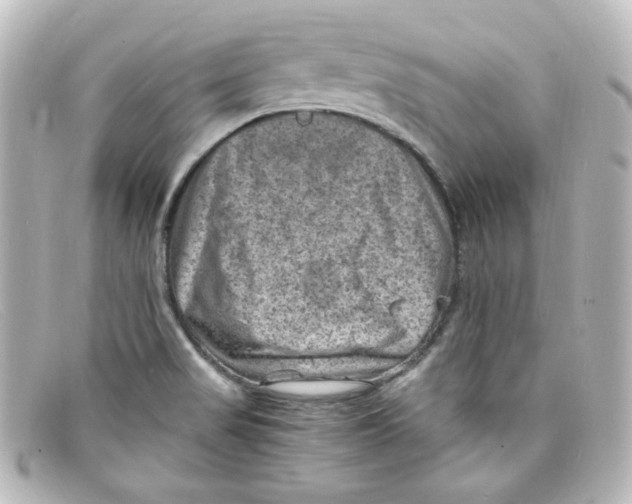 X0000098161517200805081052