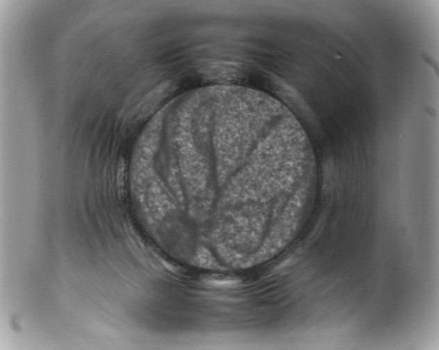X0000098160073200805151239