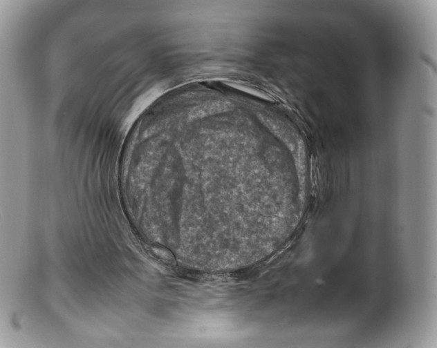 X0000098160099200805151238