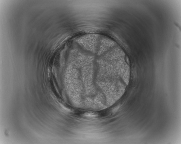 X0000098160117200805151238