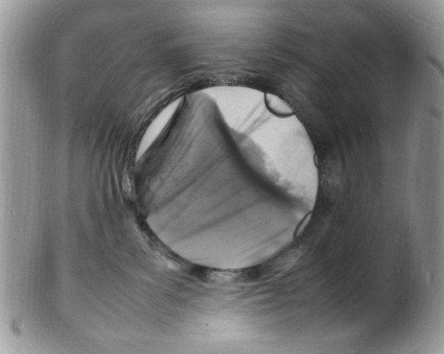 X0000098160139200805151238