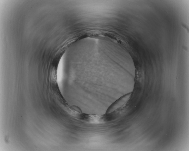 X0000098160143200805151238