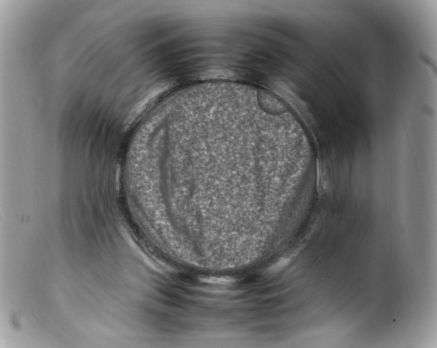 X0000098160157200805151237