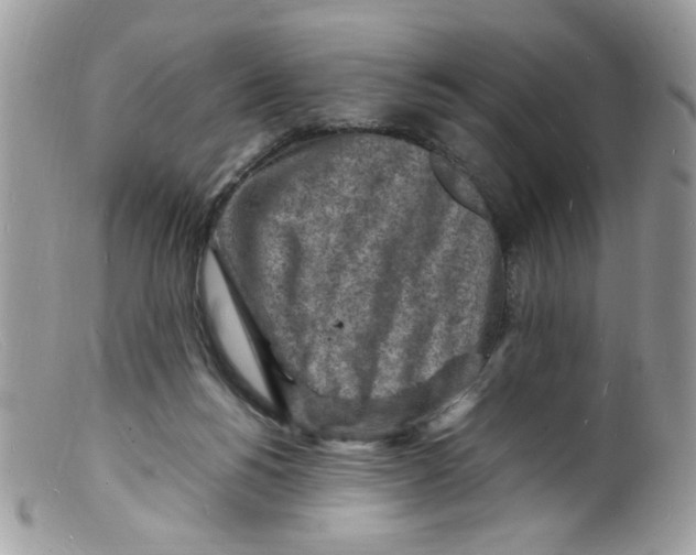 X0000098160168200805151237