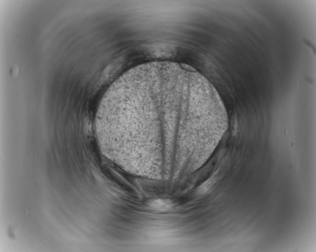X0000098160176200805151237
