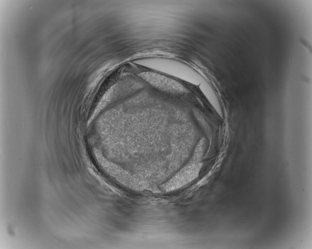 X0000098160193200805151237